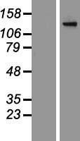 ls000108 adcy2 human over expression lysates nm 020546 wb testing 1
