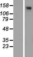 ADCY3 Human Over-expression Lysates NM_004036