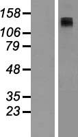 ls000114 adcy8 human over expression lysates nm 001115 wb testing 1