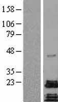 PACAP (ADCYAP1) Human Over-expression Lysates NM_001099733