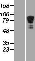 Adducin 2 (ADD2) Human Over-expression Lysates NM_001617