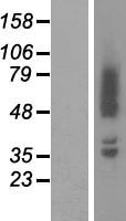 Adducin 2 (ADD2) Human Over-expression Lysates NM_017482