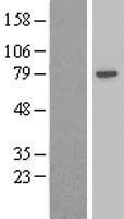 Adducin 2 (ADD2) Human Over-expression Lysates NM_017488
