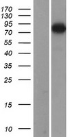 gamma Adducin (ADD3) Human Over-expression Lysates NM_016824