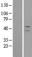 ADFP (PLIN2) Human Over-expression Lysates NM_001122