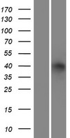 ls000130 adh6 human over expression lysates nm 001102470 wb testing 1