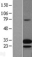 Adrenomedullin (ADM) Human Over-expression Lysates NM_001124