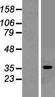Adenosine A1 Receptor (ADORA1) Human Over-expression Lysates NM_001048230