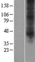 Adenosine A3 Receptor (ADORA3) Human Over-expression Lysates NM_000677