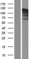 PARP1 Human Over-expression Lysates NM_001618