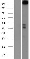 PARP4 Human Over-expression Lysates NM_006437
