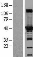 AdSS 2 (ADSS) Human Over-expression Lysates NM_001126