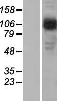 ls000163 ap2b1 human over expression lysates nm 001282 wb testing 3