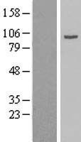 ls000164 gamma adaptin ap1g1 human over expression lysates nm 001030007 wb testing 1