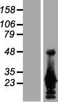 Amino terminal enhancer of split (AES) Human Over-expression Lysates NM_001130