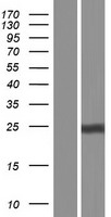 Amino terminal enhancer of split (AES) Human Over-expression Lysates NM_198970