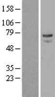 alpha 1 Fetoprotein (AFP) Human Over-expression Lysates NM_001134
