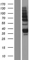 ls000175 aga human over expression lysates nm 000027 wb testing 2