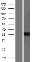 ls000175 aga human over expression lysates nm 001171988 wb testing 1