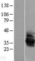 Angiotensin II Type 1 Receptor (AGTR1) Human Over-expression Lysates NM_032049