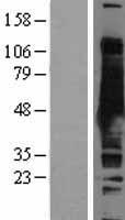 S adenosylhomocysteine hydrolase (AHCY) Human Over-expression Lysates NM_000687