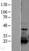 Adenylate Kinase 1 (AK1) Human Over-expression Lysates NM_000476