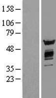 AKT2 Human Over-expression Lysates NM_001626