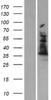 ls000210 alad human over expression lysates nm 000031 wb testing 1