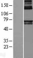 ALAS1 Human Over-expression Lysates NM_199166