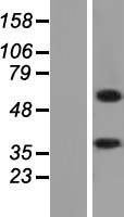 ls000212 alas2 human over expression lysates nm 001037967 wb testing 1