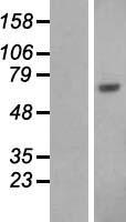 ls000213 albumin alb human over expression lysates nm 000477 wb testing 1