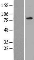 ls000215 abcd1 human over expression lysates nm 000033 wb testing 1
