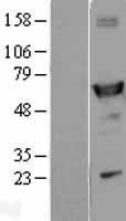 ls000216 aldh1a1 human over expression lysates nm 000689 wb testing 1