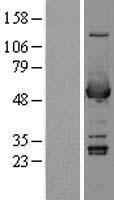 ls000218 aldh3a1 human over expression lysates nm 000691 wb testing 2