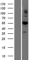 ls000219 aldh1b1 human over expression lysates nm 000692 wb testing 1