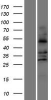 Aldehyde dehydrogenase 10 (ALDH3A2) Human Over-expression Lysates NM_000382