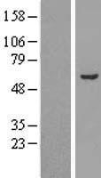 Aldehyde dehydrogenase 10 (ALDH3A2) Human Over-expression Lysates NM_001031806