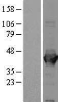 Aldolase (ALDOA) Human Over-expression Lysates NM_000034