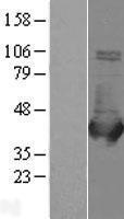 ls000229 aldob human over expression lysates nm 000035 wb testing 1
