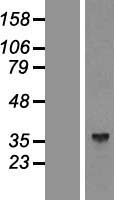Aldolase C (ALDOC) Human Over-expression Lysates NM_005165