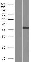 AKR1B1 Human Over-expression Lysates NM_001628