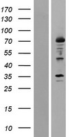 ls000239 12 lipoxygenase alox12 human over expression lysates nm 000697 wb testing 1