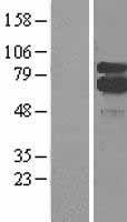 5 Lipoxygenase (ALOX5) Human Over-expression Lysates NM_000698