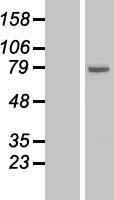 ALOX15 Human Over-expression Lysates NM_001140