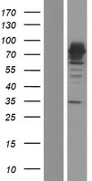 ls000247 15 lipoxygenase 2 alox15b human over expression lysates nm 001039130 wb testing 2