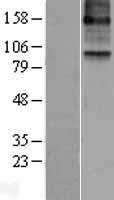 ls000247 15 lipoxygenase 2 alox15b human over expression lysates nm 001141 wb testing 1