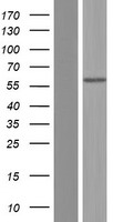 Alkaline Phosphatase (ALPL) Human Over-expression Lysates NM_001177520