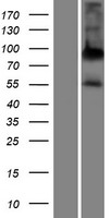 Alkaline Phosphatase (ALPPL2) Human Over-expression Lysates NM_031313