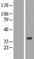 AMD1 Human Over-expression Lysates NM_001634