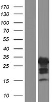 AMELX Human Over-expression Lysates NM_001142